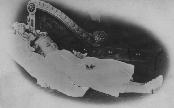 Postmortem Photo of a child